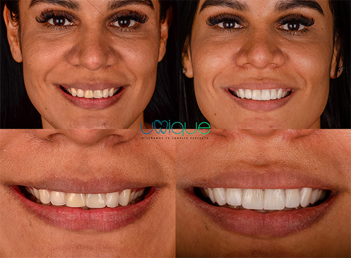 Slider image (3) Unique Dental Clinic